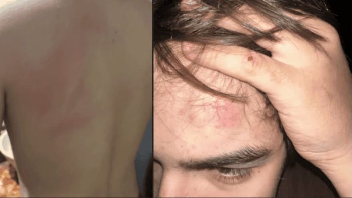 Denuncian a un entrenador de rugby por agredir a un adolescente que intentaba separar una pelea entre perros