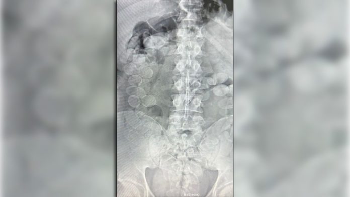 Ataparon a dos mulas que habían ingerido más 185 cápsulas de cocaína en un tour de compras que se dirigía a Buenos Aires